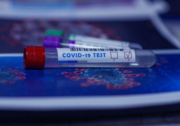 Восемь умерших: какая статистика Covid-19 в Одесской области
