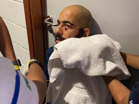 У Бразилії в автобусі з футболістами вибухнула бомба: є поранені