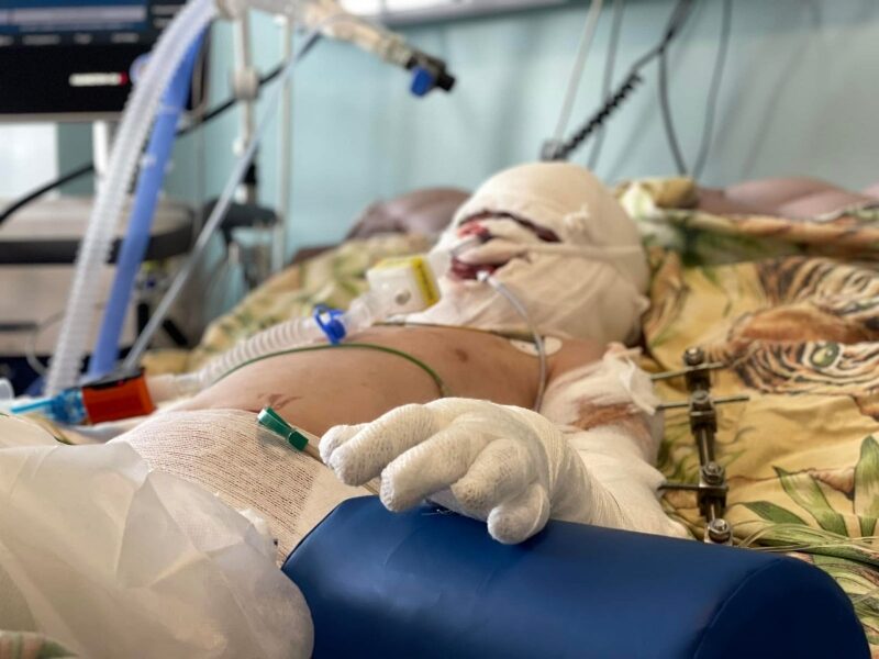 Зросла кількість жертв ракетного удару по&nbsp;Вінниці