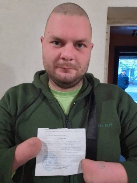 Для військкомату майже всі чоловіки — «здорові»: на Прикарпатті визнали обмежено придатним для служби інваліда без кистей рук