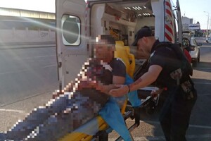 В Одессе парень прямо на улице пытался покончить с собой