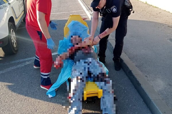 В Одессе парень прямо на улице пытался покончить с собой