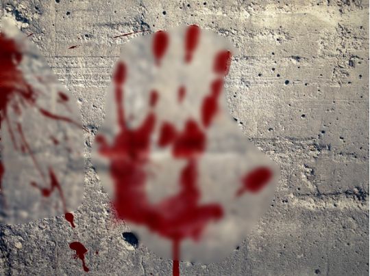 Відрізали в живої людини: Макрону поштою надіслали… палець