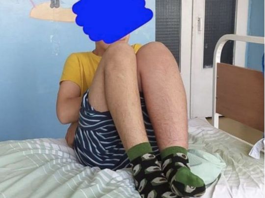В Києві по-звірячому побили хлопчика: через важку травму довелось робити операцію