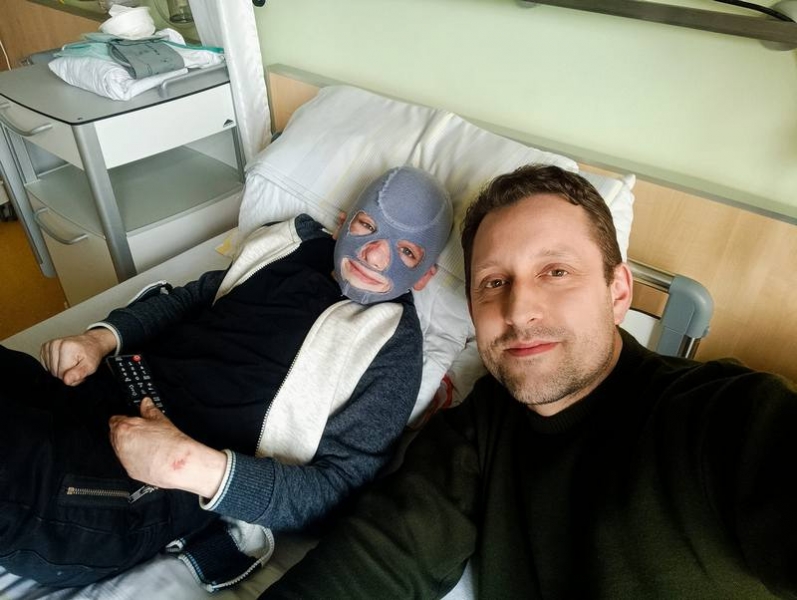 Опіки були до кісток, уламки застрягли в черепі: про хлопчика, який дивом вижив під час ракетного удару рф по Вінниці, знімають в Англії фільм